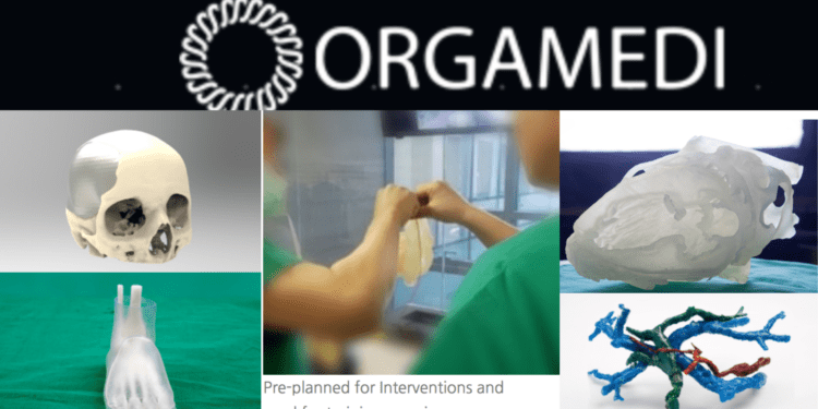 Korean startup Orgamedi's 3D print products of artificial human organs.