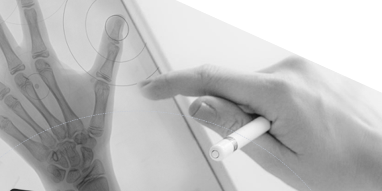 Crescom is a venture startup that develops an automatic AI medical image analysis solution