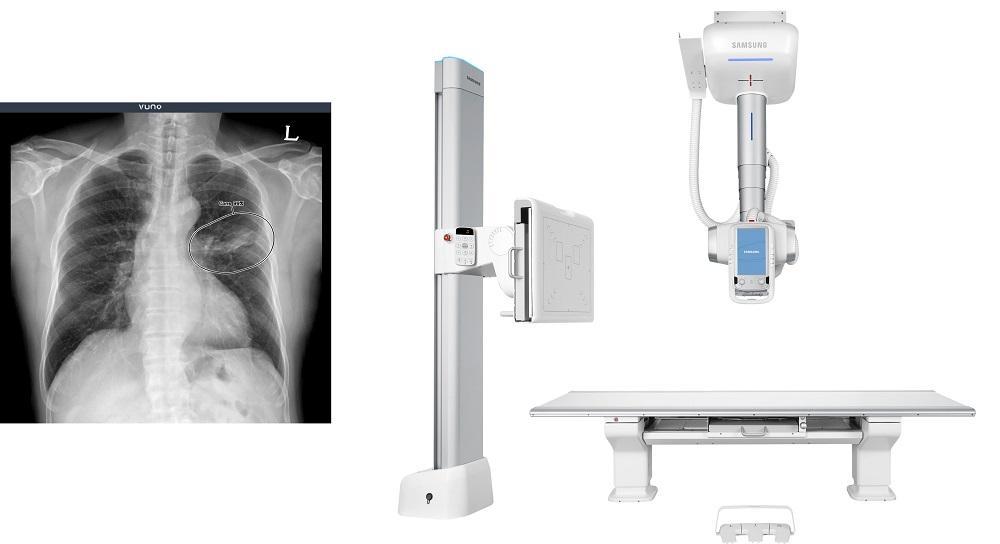 VUNO Med®-Chest X-ray™ & GC85A