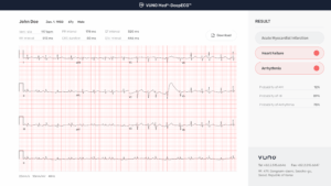 Ministry of Food and Drug Safety(KFDA) designates VUNO Med®-DeepECG™, an AI based electrocardiogram(ECG) analysis software, as a Breakthrough Device.