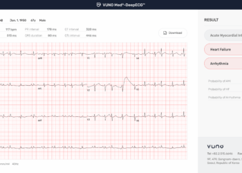 Ministry of Food and Drug Safety(KFDA) designates VUNO Med®-DeepECG™, an AI based electrocardiogram(ECG) analysis software, as a Breakthrough Device.