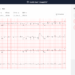 Ministry of Food and Drug Safety(KFDA) designates VUNO Med®-DeepECG™, an AI based electrocardiogram(ECG) analysis software, as a Breakthrough Device.